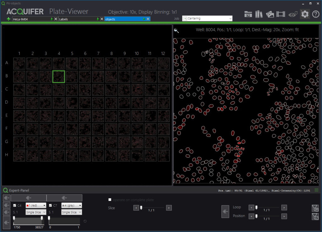 Image of segmented cells in the Plate-Viewer