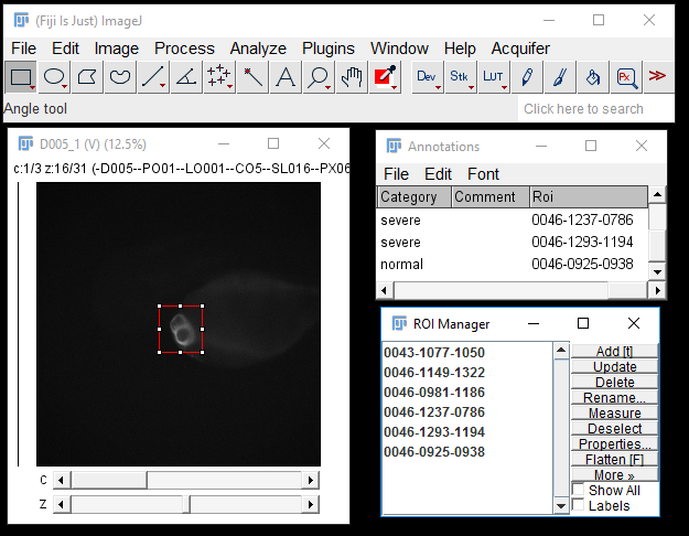 Image annotations