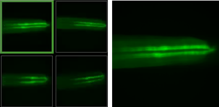 High-resolution images before ablation