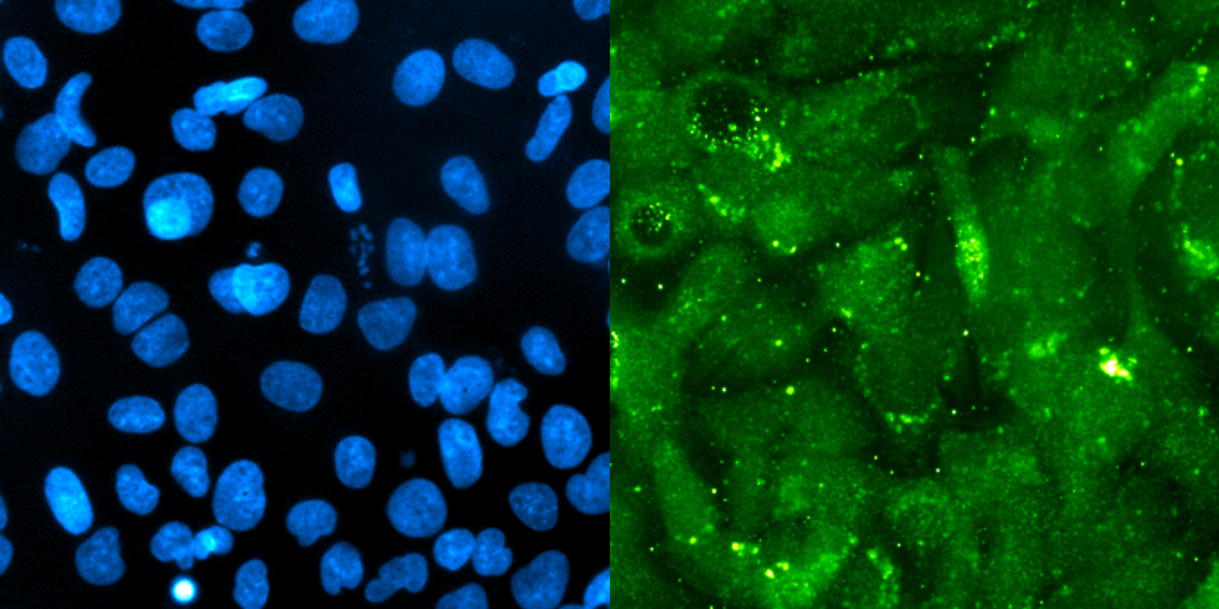 microscopy image of mouse liver cells infected by plasmodium