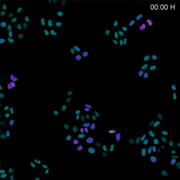 Timelapse microscope acquisition of HeLa cells imaged with 20X objective